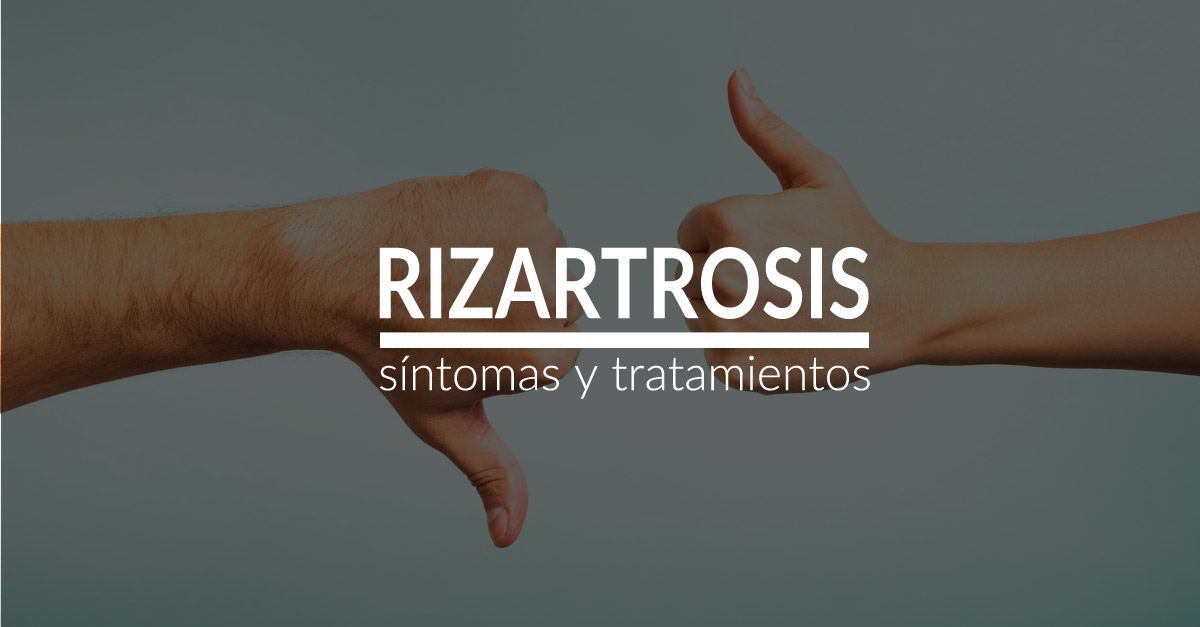 Rizartrosis o artrosis del pulgar. Síntomas, tratamiento y recuperación