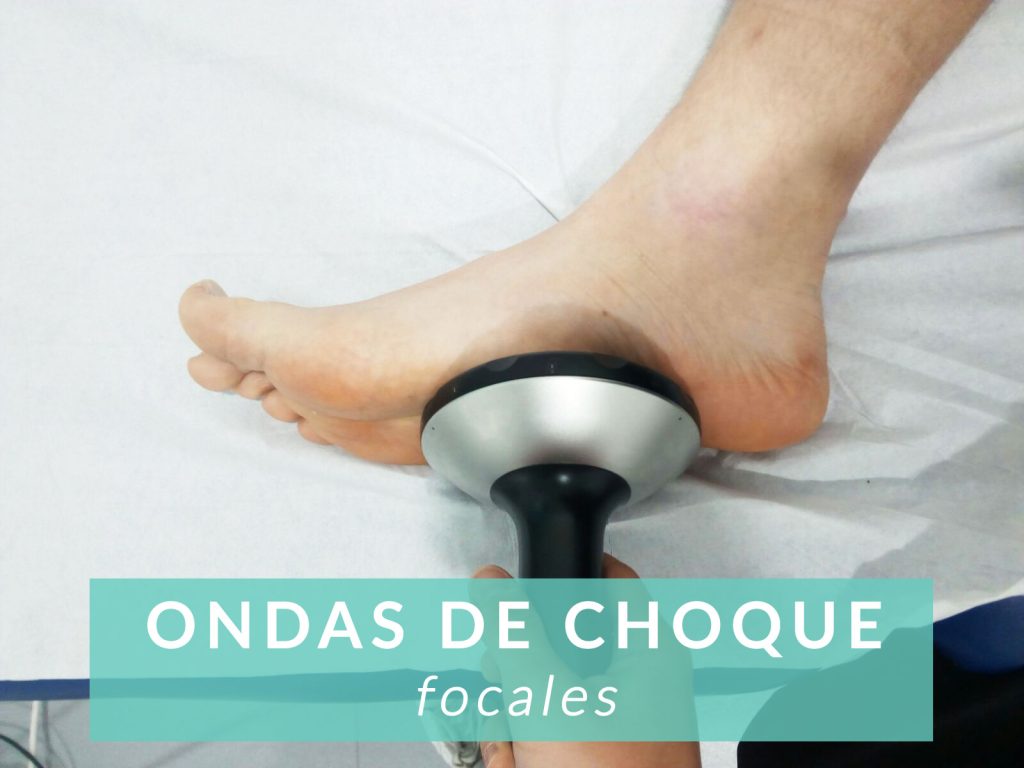 Tratamiento de ondas de choque focales en vigo